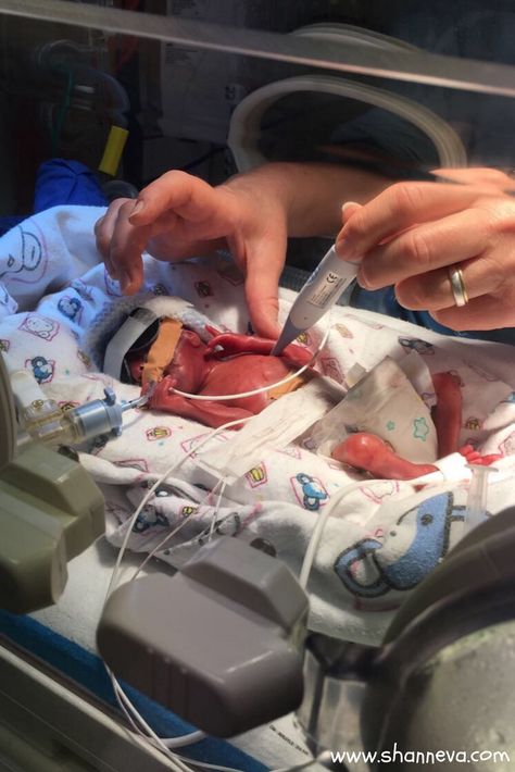 Support in the NICU: Luca's Story - Shann Eva's Blog Nursing School Inspiration, Nursing Motivation, Medical School Life, My Future Job, Premature Birth, Nurse Inspiration, Nurse Aesthetic, Med School Motivation, Neonatal Nurse