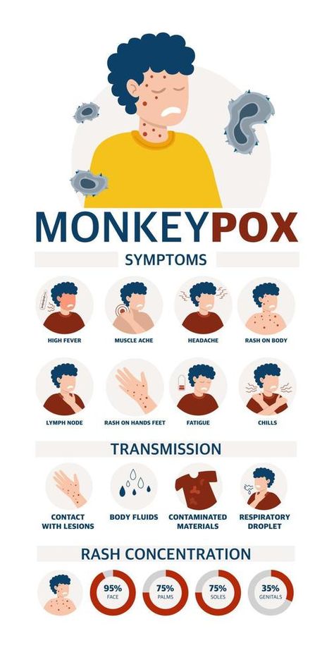 Monkey pox virus Poster to inform about the pandemic and the spread of the disease Images of human methods of spread and symptoms of the disease Vector illustration Poster Virus, Rash On Hands, Body Rash, High Fever, Text Logo Design, Body Fluid, Lymph Nodes, Muscle Aches, Graphic Elements