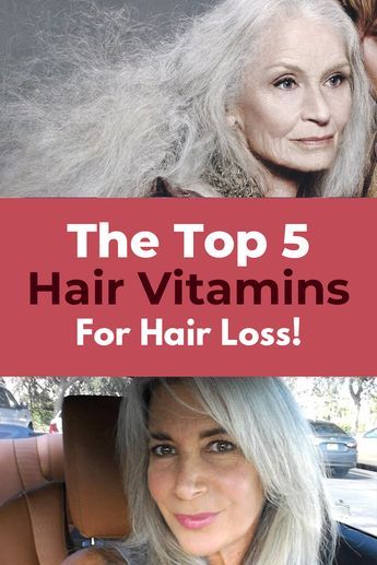 Learn how to find the best hair vitamin for you and why Amazon is the worst place to go to for reviews.. Best Hair Vitamins, Vitamins For Hair, Everyday Hair, Vitamins For Hair Growth, Hair Help, Hair Vitamins, Hair Remedies, Best Hair, Grow Hair