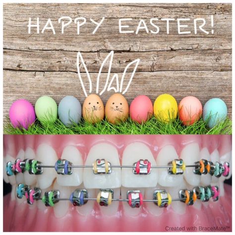 Easter braces colors – bracemateapp Dental Braces Colors, Braces Colors Combinations, Invisible Teeth Braces, Lingual Braces, Cute Braces Colors, Braces Cost, Kids Braces, Braces Tips, Getting Braces