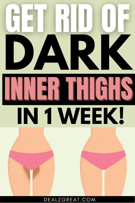 10 Natural Treatments to Lighten Your Dark Inner Thighs Fast! Dark Inner Thighs, Skin Lightening Diy, Natural Skin Lightening, Reduce Thigh Fat, Exercise To Reduce Thighs, Dark Underarms, Thigh Fat, Daily Health Tips, Lighten Skin