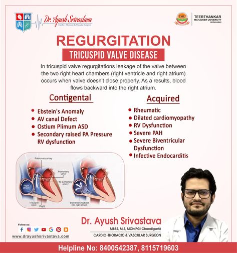 Dr. Ayush Srivastava Offcial REGURGITATION TRICUSPID VALVE DISEASE Dr. Ayush Srivastava MBBS, M.S, MCh (PGI Chandigarh) CARDIO-THORACIC & VASCULAR SURGEON #drayushrivastava #cardiologydoctorinmoradabad #mics #vats #doctors #cardiologist #lungsdoctor #moradabad #tmuhospital #moradabadhospital #heartdoctor #cardiodoctor #heartsurgeon #heartsurgery #childheart #childrencardio Tricuspid Valve Regurgitation, Pgi Chandigarh, Tricuspid Valve, Chandigarh, Blood Flow, M S, Cardio, Disease, Health