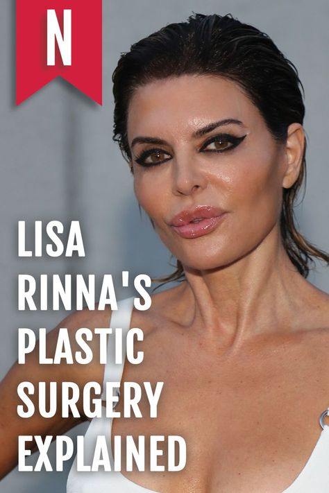 Referring to her lip surgery, she said, "I feel like I'm a pioneer. I'm going to take it on now. I was one of the first ones to ever do it and be honest about it." ... The star eventually capitalized on her famous pout by creating a lip line called Rinna Beauty. So, what cosmetic procedures has Rinna actually had done? Read on for the inside scoop on Rinna's plastic surgery transformation. #lisarinna #hwobh #realhousewives #realitytv Cosmetic Surgery Before And After, Nose Plastic Surgery Before After, Robin Mcgraw Plastic Surgery, Kris Jenner Plastic Surgery, Lip Plastic Surgery, Kpop Plastic Surgery, Bad Celebrity Plastic Surgery, Botched Plastic Surgery, Extreme Plastic Surgery