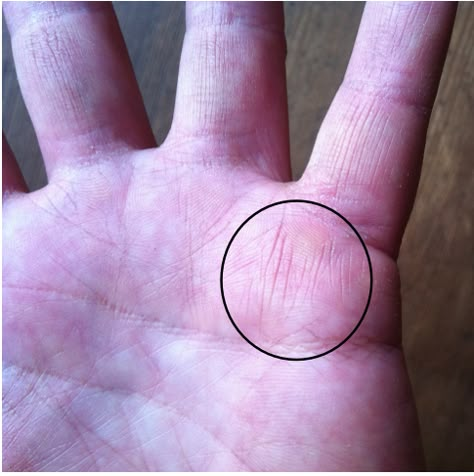 What Does The Lines On Your Hand Mean, Witch Birthmarks, Healers Mark Palm, Palm Signs Of A Witch, Palm Markings, Finger Elements, Witch Markings, Healer Witch, Hand Reading