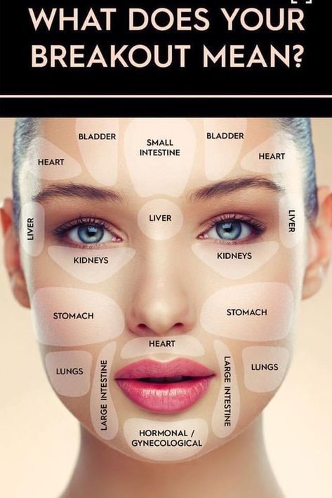 Gesicht Mapping, Skincare Routine 30s, Face Map, Face Remedies, Face Mapping Acne, Forehead Acne, Body Toxins, Acne Makeup, Face Mapping