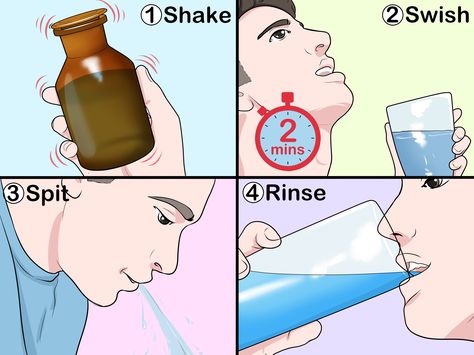 How to Make Hydrogen Peroxide Mouthwash Hydrogen Peroxide Mouth Rinse, Peroxide Mouth Rinse, Magic Mouthwash Recipe, Hydrogen Peroxide Mouthwash, Hydrogen Peroxide Teeth, Food Grade Hydrogen Peroxide, Homemade Mouthwash, Mouth Rinse, Spearmint Essential Oil