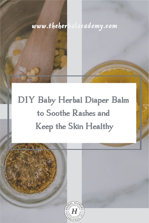 Baby Remedies, Baby Balm, Botanics Skin Care, Herbal Oil, Baby Skin Care, Natural Baby, Medicinal Herbs, Herbal Medicine, Diy Natural Products