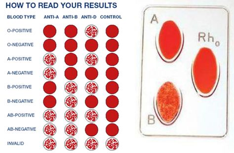 How to find different types of blood groups Ab Positive, Biology Diagrams, Blood Group, Blood Groups, 8th Sign, Blood Type, How To Find, How To Know, Different Types