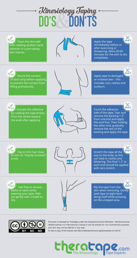 Kinesiology Taping Do's and Don't Infographic from Theratape.com K Tape, Kinesio Taping, Sports Tape, Kinesiology Taping, Do's And Don'ts, Athletic Training, Education Center, Sports Medicine, Physical Therapist