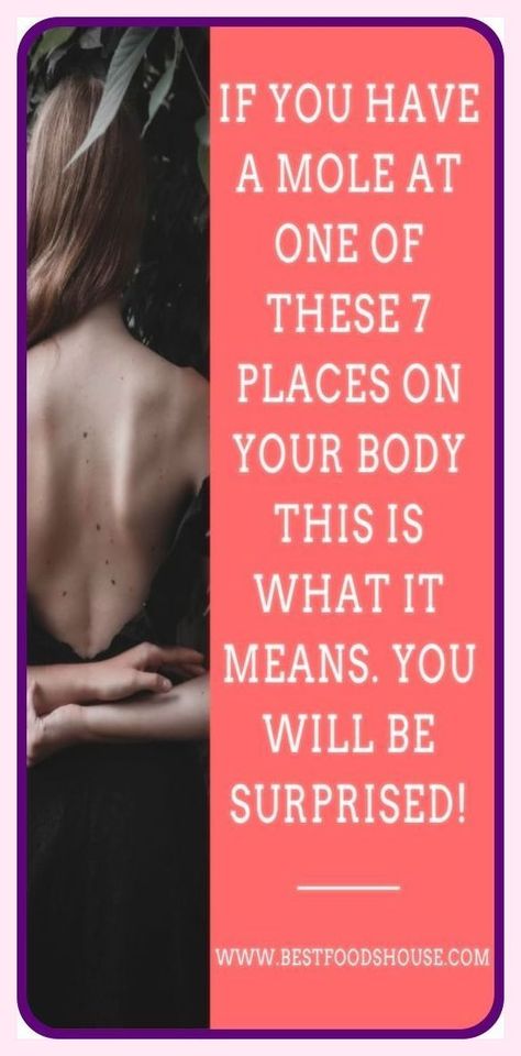 IF YOU HAVE A MOLE AT ONE OF THESE 7 PLACES ON YOUR BODY THIS IS WHAT IT MEANS-YOU WILL BE SURPRISED Mole Meaning, Natural Remedies For Allergies, Turmeric Health, Natural Headache Remedies, Get Rid Of Warts, Holistic Medicine, Wellness Tips, Healthy Tips, Mole