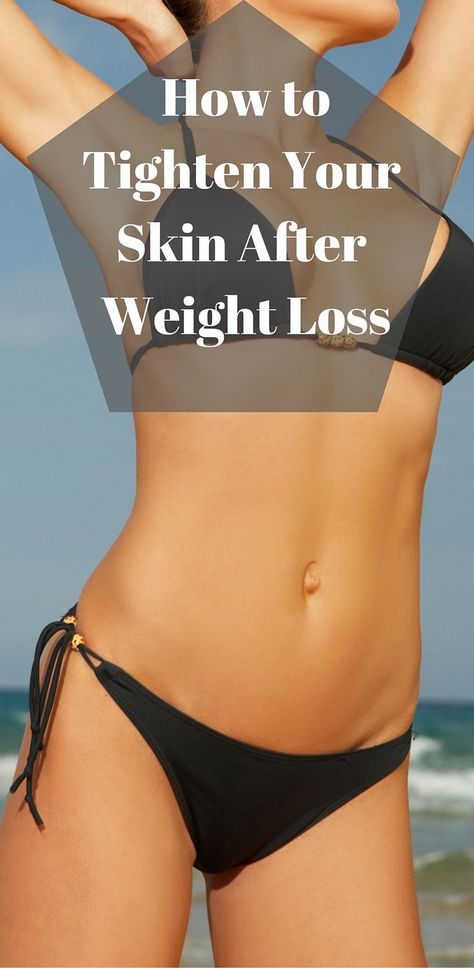 Learn what to do to get rid of loose skin after weight loss...without surgery! Get Rid Of Loose Skin, Tighten Stomach, Skin Tightening Stomach, Tighten Loose Skin, Skin Bumps, Saggy Skin, Loose Skin, Lose 50 Pounds, Stubborn Belly Fat