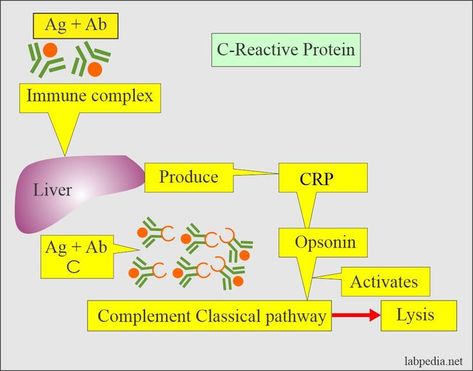 Acute-phase protein (Acute Phase Reactants) Acute-phase proteins are raised in inflammatory conditions; these may be called: Acute inflammatory response pattern. Acute stress pattern. Acute-phase protein pattern. Acute stress pattern. When there is an increase in an acute-phase protein called positive acute-phase protein. In the case of a decrease in the acute phase protein, it is called the negative phase protein. The acute phase proteins (positive) ... Clinical Laboratory, Acute Coronary Syndrome, Systemic Inflammation, Cardiac Disease, C Reactive Protein, Gi Tract, Bacterial Infection, Chronic Inflammation, Urinary Tract