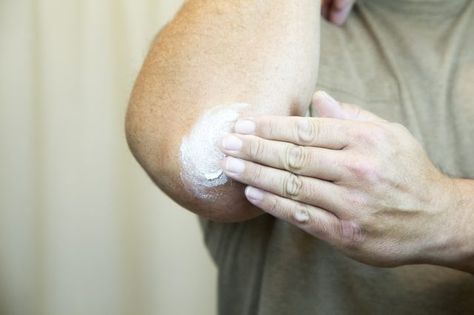 How to Get Rid of Dark, Rough Elbows Rough Elbows, Dry Elbows, Dark Elbows, Dark Underarms, Dry Skin Remedies, Face Scrub Homemade, Health Hacks, Dry Skin Patches, Rough Skin