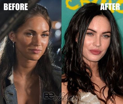 Megan Fox Lips, Megan Fox Lips Before And After, Megan Fox Transformers Makeup, Megan Fox Nose Job, Fox Nose, Megan Fox Makeup 2000s Tutorial, Nose Aesthetic, Megan Fox Look Alike, Lip Job