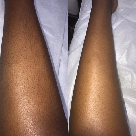 Waxing Legs, Skin Care Business, Nail Care, Year Old, Wax, Skin Care, Skin, Black