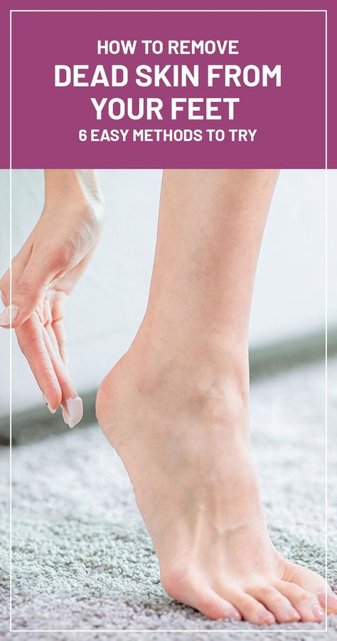 Read on to know some ways of removing the dead skin from the feet. Dead Skin On Feet Removal, Get Rid Of Dry Skin, Closed Shoes, Dead Skin Removal, Simple Health, Get Rid Of Blackheads, Healthy Skin Tips, Diy Skin, Saved Items