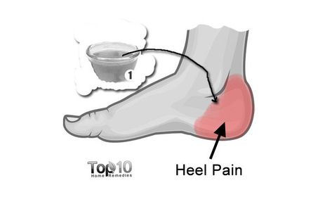 How to Get Relief from Heel Pain Naturally Heal Spurs, Apple Cider Vinegar Uses, Headache Relief Instant, Strengthen Your Back, Migraine Remedies, Lumbar Pain, Natural Headache, Heel Pain Relief, Pain Relief Remedies