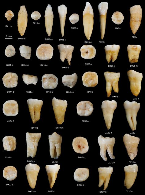 African Ancestors, Teeth Aesthetic, Human Migration, Journal Nature, Dental Anatomy, Human Teeth, Loose Tooth, Fossil Teeth, Oil Pulling