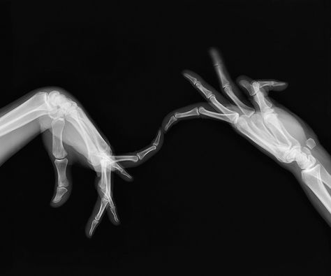 Artist uses hand x-rays to grasp meaning behind scans  Pictured: Hand dancing series. © Marc Ferrante. Xray Art, Black Aesthetic Wallpaper, Black And White Aesthetic, Rimmel, Aesthetic Grunge, White Aesthetic, Grunge Aesthetic, X Ray, Black Aesthetic