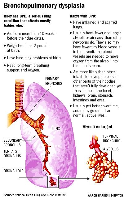 Lpn Program, Bronchopulmonary Dysplasia, What Is Nursing, Nursing Fun, Chronic Lung Disease, Child Nursing, Serve Others, Neonatal Nurse, Respiratory Care