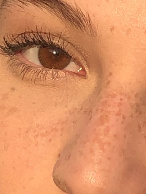 Brown Eyes And Freckles Aesthetic, Brown Hair Brown Eyes Freckles Girl, Light Freckles On Nose Aesthetic, Freckled Skin Aesthetic, Freckles Aesthetic Faceless, Birthmarks For Shifting, Brown Eyes With Freckles, Cute Freckles Aesthetic, Brown Hair Brown Eyes Freckles