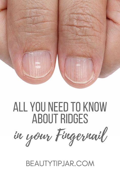 Nail Infection Fingernail Ridges, Fingernail Health, Nail Remedies, Nail Ridges, Nails Care, Layers Of The Epidermis, Ingrown Toenail, Nail Infection, Fungal Nail