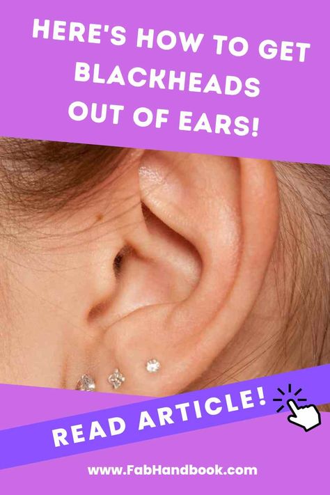 Ears need some TLC? Get ready to banish those pesky blackheads with our expert-approved tips and tricks. And prevent them from coming back again. Pimples In Ear, Zit Remedy, Clean Blackheads, Cold Medicine, Home Remedy For Cough, Skin Natural Remedies, Cold Sores Remedies, Ear Care, Get Rid Of Blackheads