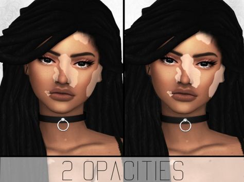 SimplyPixelated - Vitiligo Overlay Vilitigo Skin, Sims 4 Cc Vilitigo Skin, The Sims 4 Kids, Cc Skin, The Sims 4 Skin, Sims 4 Cc Kids Clothing, Makeup Cc, The Sims 4 Pc, Sims 4 Cc Shoes