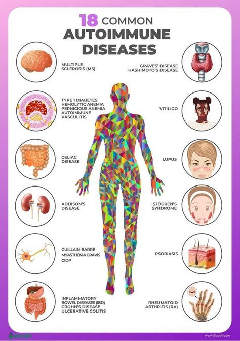 18 Common Autoimmune Diseases #medschool #doctor #medicalstudent - Image Credits: Audrey Herman Silent Killer, Sjogrens Syndrome, Hashimotos Disease, Auto Immune, Graves Disease, Disease Symptoms, Gluten Sensitivity, Autoimmune Disorder, Medical Knowledge