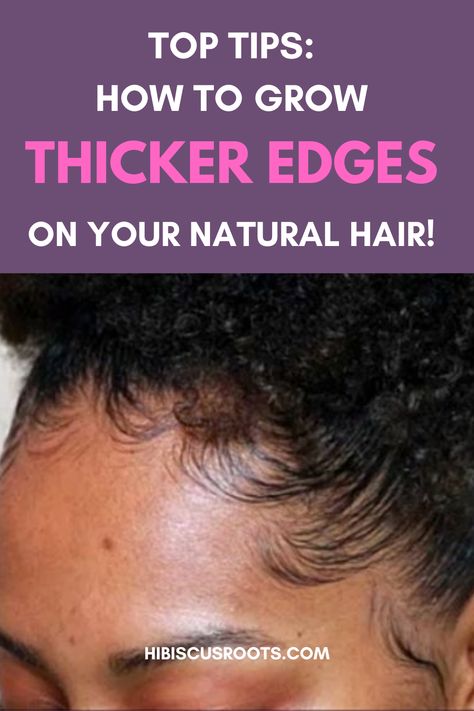 Read this article for top tips on how to regrow thinning edges back fast! How to care for your edges and hairline. How to grow your edges thinner. and how to get thicker, fuller edges and baby hairs on your natural hair! All while using natural and ayurvedic methods! #edges #babyhair #sleekedges #edgeshairstyles Hairline Growth Black Hair South Africa, How To Grow Edges Back Fast, Edges On Natural Hair, Regrow Hairline, Grow Baby Hair, Grow Edges, Thick Edges, Growing Long Hair Faster, Thinning Edges