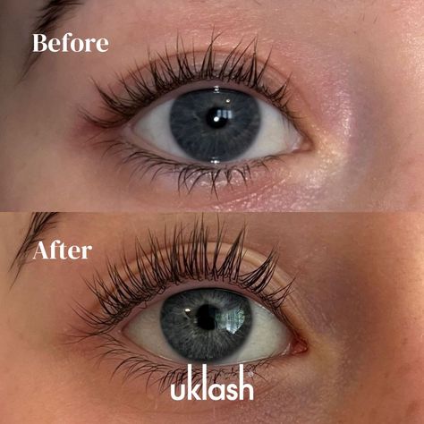 Eyelash Serum, Eyelashes, Serum, Lashes, Makeup