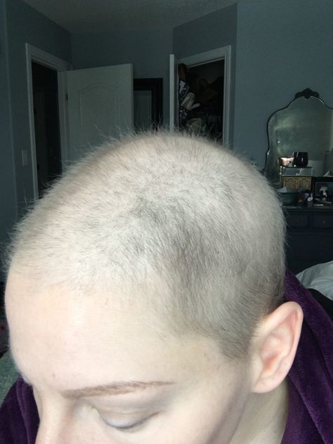 Growing Hair After Chemo, Hair Growth Post Chemo, Tips For Hair Growth, Hair Growth After Chemo, Tips For Hair, Chemo Care, Chemo Hair, Boost Hair Growth, For Hair Growth