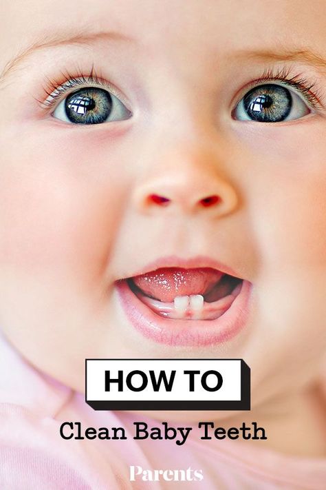 Even though your baby's primary teeth fall out, taking care of them is essential for their gums and those future permanent teeth. Here are the best tips for keeping your little one’s teeth clean. #baby #healthandwellness #babyteeth White Teeth Overnight, Baby Bottle Tooth Decay, Taking Care Of Baby, Get Whiter Teeth, Dental Photography, Kids Dentist, Cleaning Videos, Baby News, Pediatric Dentist