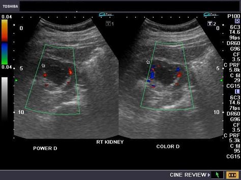 Medical Sonography, Diagnostic Medical Sonography, Science Nerd, 3d Images, Health Knowledge, Blood Vessels, Ultrasound, Medical, Health