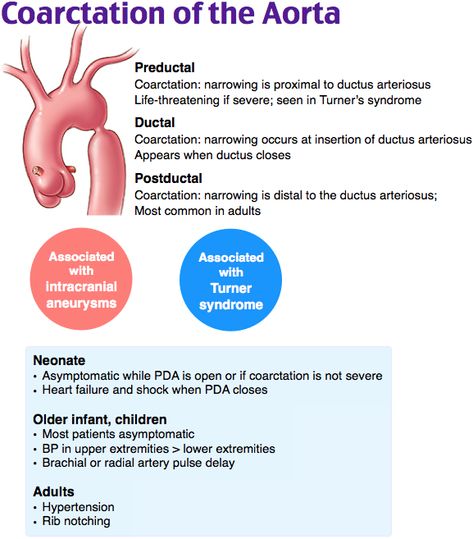 Coarctation of the Aorta Respiratory Therapy Notes, Coarctation Of The Aorta, Cardiac Sonography, Physician Assistant School, Nursing Mnemonics, Cardiac Nursing, Respiratory Therapy, Nursing School Tips, Medical School Studying