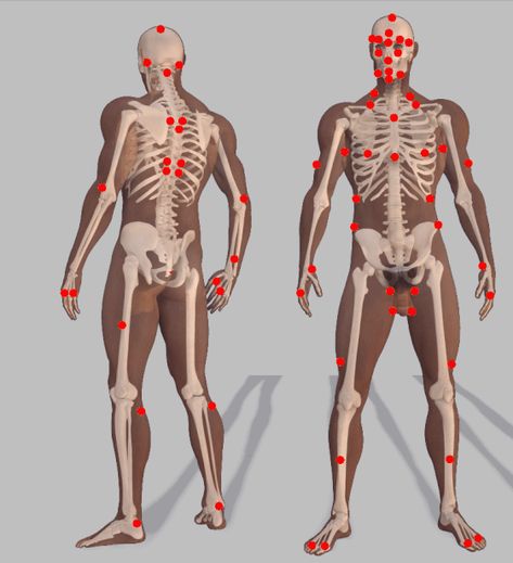 DIM MAK PRESSURE POINT CHART.............. Pressure Point Chart, Pressure Points Chart, Dim Mak, Pressure Point, Pressure Points, Humanoid Sketch, Anime, Pins, Quick Saves