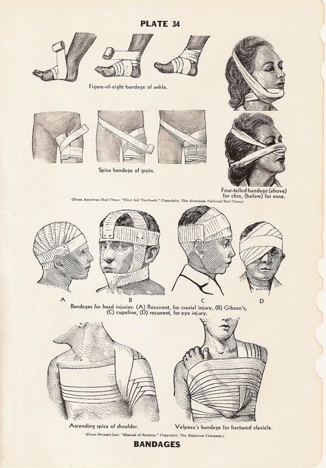 Bandage Art Reference, Loose Bandages Drawing Reference, Neck Bandage Reference, Bandage Medical Aesthetic, Vintage Reference Photos, 1800s Medical Aesthetic, Injury Art Reference, Old Medical Aesthetic, Stitches Drawing Medical