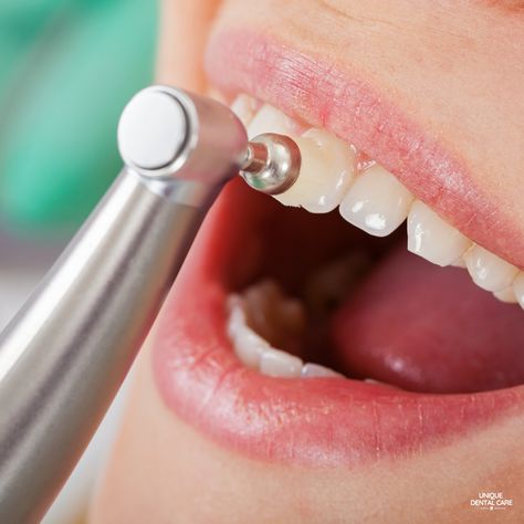 Deep Teeth Cleaning, Laser Dentistry, Implant Dentistry, Nice Teeth, Dental Cleaning, Dental Teeth, Family Dentistry, Natural Teeth Whitening, Dental Problems