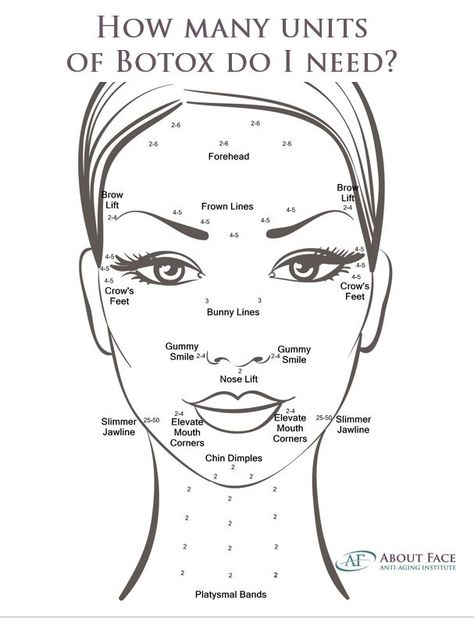 how many units of botox do i need Botox Forehead, Botox Injection Sites, Botox Facial, Facial Injections, Botox Brow Lift, Botox Before And After, Botox Lips, Aesthetic Dermatology, Facial Anatomy