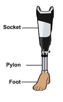 Below The Knee Prosthetic Leg, Below Knee Prosthetic Leg, Prosthetics Design, Prosthetic Leg Design, Below The Knee Amputation, Leg Prosthesis, Leg Reference, Orthotics And Prosthetics, Wheelchairs Design