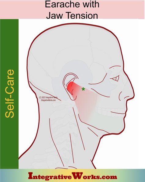 Self-care includes activities that aggravate this pain pattern, quick relief strategies, stretches for longer lasting relief and yoga tips. Jaw Pain Relief, Masseter Muscle, Lower Leg Pain, Anatomy Medical, Forearm Muscles, Neck Problems, Elbow Pain, Jaw Pain, Head Pain