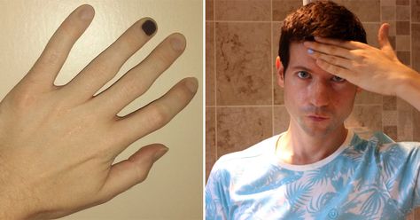 Men who paint one fingernail are helping to raise awareness about a very… Fingernails Painted, Neon Prom Dresses, Red Meaning, Polished Man, Why Do Men, Fingernail Polish, Nail Pictures, Popular Nail Designs, Tattoo Trends