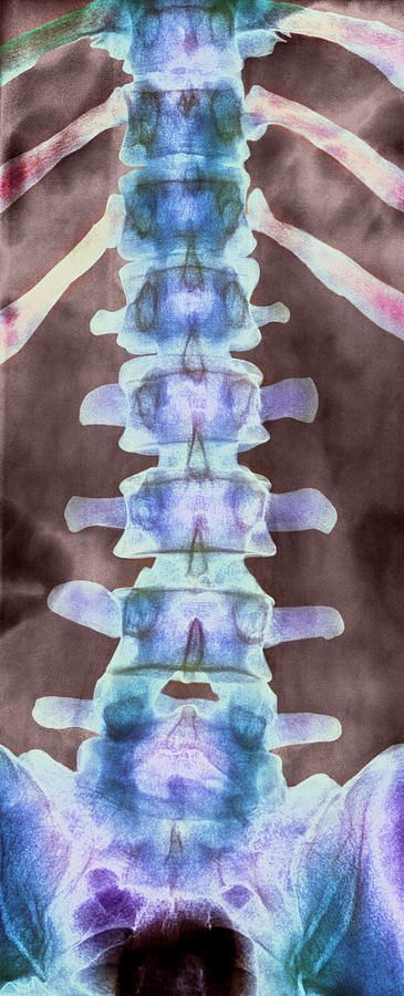 Xray Art Wallpaper, Art In Medicine, X Ray Painting, Spine Art Reference, Spine Art Drawing, Spine Wallpaper, Xray Drawing, X Ray Wallpaper, Spine Xray