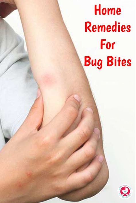 Don't scratch that itch! Here are 8 effective home remedies for bug bites to get rid of the irritation without any harmful side effects. Remedies For Bug Bites, Bug Bite Itch, Itchy Bug Bites, Bug Bites Remedies, Ancient Remedies, Bug Repellant, Bug Bite, Common Knowledge, Kitchen Herbs