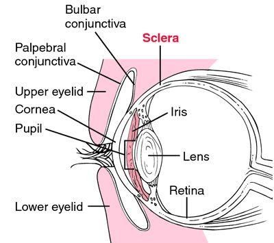 Blue sclera | definition of blue sclera by Medical dictionary Bilirubin Levels, Osteogenesis Imperfecta, Eye Structure, Meaning Of Blue, Medical Dictionary, Genetic Disorders, Medical Terms, Ehlers Danlos Syndrome, Consumer Health