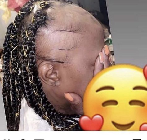 Ugly Hair, Funny Face Photo, Birthday Hairstyles, Funny Black People, Fake Hair, Pretty Braided Hairstyles, Girls Hairstyles Braids, Instagram Funny Videos, Hilarious Memes