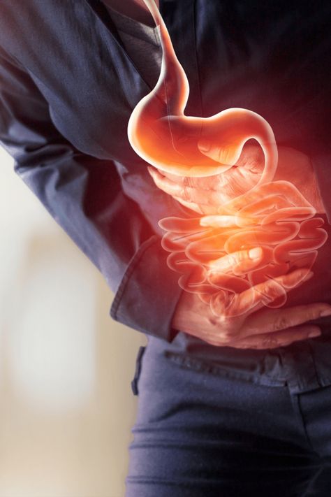 Explore exactly what leaky gut syndrome is, how this malfunction of your digestive tract can have a major impact on your overall health, how you can use a specific dietary approach (known as the specific carbohydrate diet) to help heal leaky gut, and go over some additional steps you can take to facilitate healing if you’re concerned that you may be battling this perplexing condition. Medicine Aesthetic, Cellular Healing, Stomach Health, Heal Leaky Gut, دورة شهرية, Gall Bladder, Point Acupuncture, Sistem Pencernaan, Medical Profession