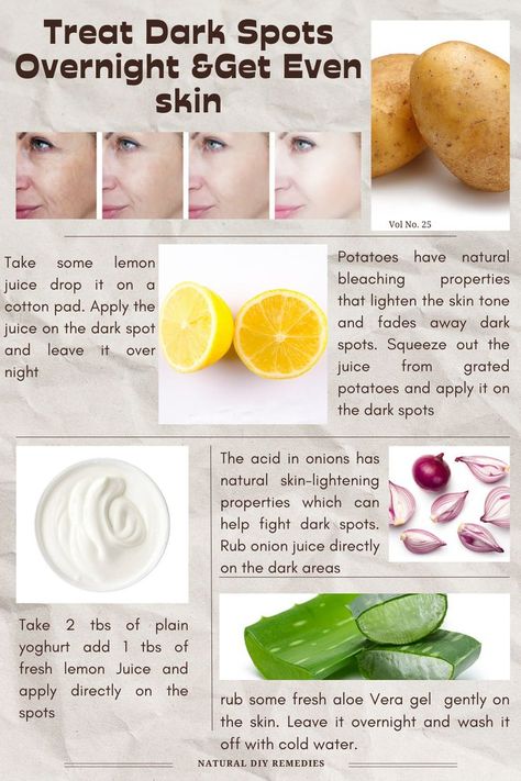 How To Remove Dark Spots On Face, Natural Skin Lightening, Onion Juice, Dark Spots On Face, Ayurvedic Healing, Spots On Face, Skin Glowing, Remove Dark Spots, Get Even