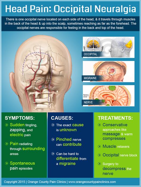 Head Pain Occipital Neuralgia Headache Map, Occipital Nerve Block, Migraine Tips, Migraine Help, Occipital Neuralgia, Muscle Knots, Chiari Malformation, Head Pain, Cervical Spine