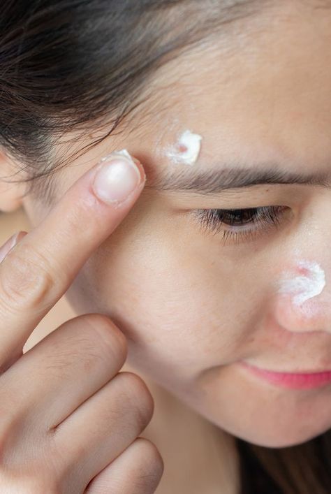 These acne spot treatments featuring ingredients like aspirin and tea tree oil have been approved by dermatologists to try at home. #beautyhacks #beautytips #acnetreatment #acneremedies Baking Soda For Skin, Tee Tree Oil, Facial Massage Techniques, Baking Soda Benefits, Pimples Overnight, Pimples Remedies, Diy Acne, Acne Causes, How To Get Rid Of Pimples